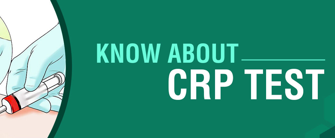 How much does the CRP test cost in India?